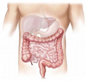Barcelona y el cáncer de colon