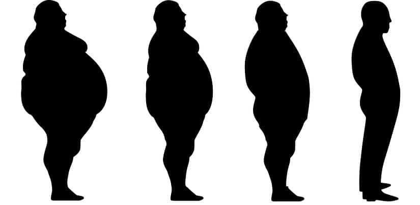 Fotos de casos celebres de obesidad mórbida