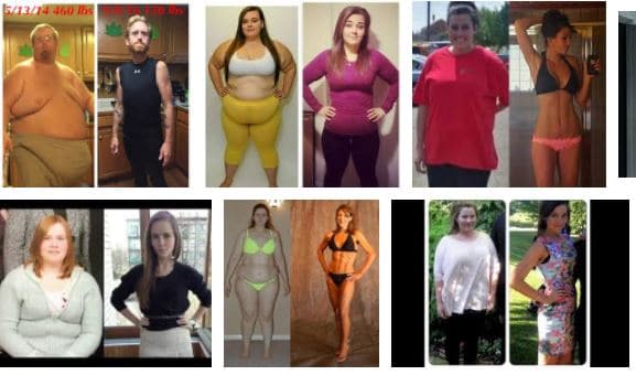 obesidad mórbida antes y después