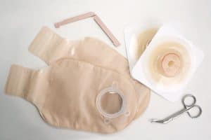 Qué es una ostomía