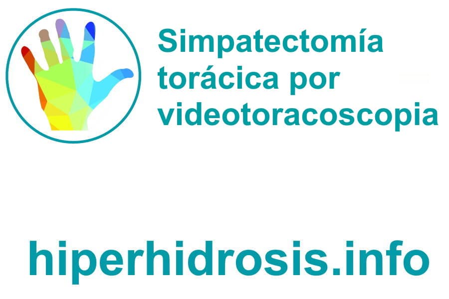 Hiperhidrosis tratada por simpatectomía torácica por videotoracoscopia. Un tratamiento desfasado