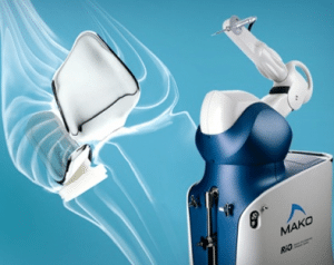 Tratamiento de la artrosis de rodilla con el brazo robótico MAKO