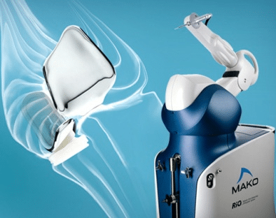 Tratamiento de la artrosis con el brazo robótico MAKO. Imagen del robot