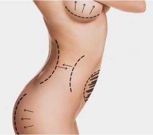 Razones por las que confiar en tu doctora antes de una cirugía estética