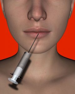La hiperhidrosis o exceso de sudoración: tratamiento con toxina botulínica