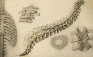La Cifoescoliosis