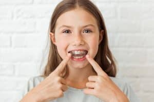 Tus brackets siempre limpios