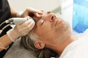 Neuromoduladores en tratamientos de belleza masculina