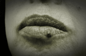 Lagos venosos labiales