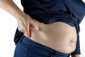 Celulitis: Origen, tipos y tratamientos