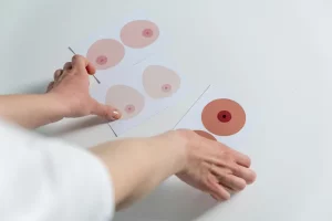 El descontrol en los cribados del cáncer de mama en Andalucía. Preparando una reconstrucción.