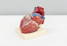 Cateterismo en cardiología